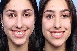 Best Cosmetic Injectables Dubai