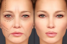 Cosmetic Injectables Dubai